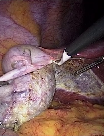 GT frame video12_19980