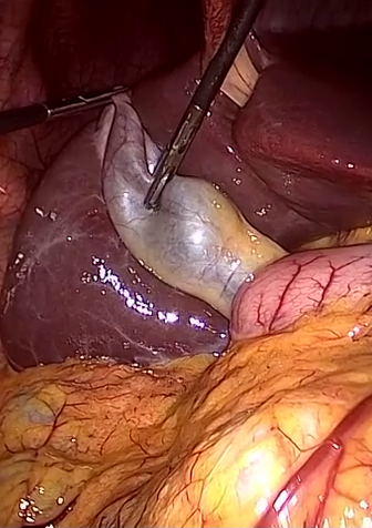 GT frame video24_09676