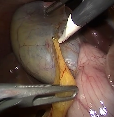 GT frame video55_00588